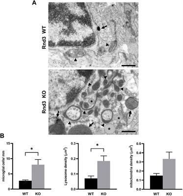 Rnd3 Expression is Necessary to Maintain Mitochondrial Homeostasis but Dispensable for Autophagy